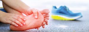 5 mitos sobre el pie de atleta